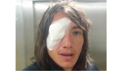 Lugüercio, tras la agresión de un hincha visitante: "La saqué bastante barata"