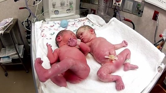 #EsViral El emotivo vínculo entre dos gemelos recién nacidos al ser unidos de nuevo