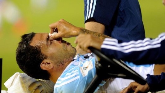Tevez sufrió una fisura en el tabique nasal, pero jugará