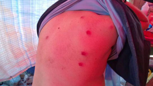 Represión de protesta antiminera deja dos heridos, entre ellos un diputado