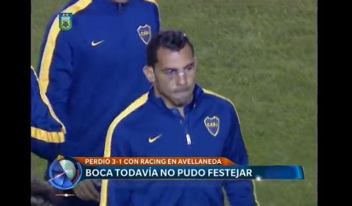 Telefe Noticias a las 13 - Bloque 3 - Lunes 19 de Octubre de 2015