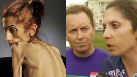 La mujer que pidió ayuda por Internet y se recuperó de la anorexia