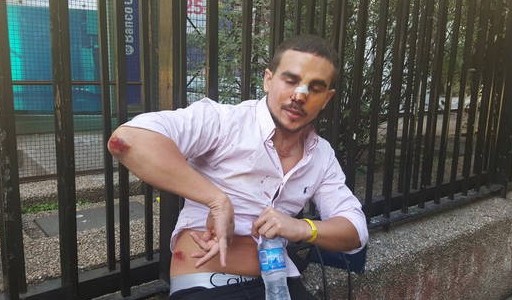 Denunció que patovicas de un boliche de Palermo lo golpearon hasta dejarlo inconsciente