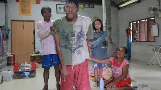 A los 26 años, murió el hombre más alto del mundo