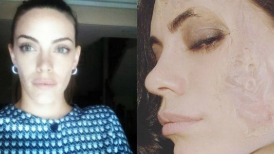 Foto impactante: ¿qué le pasó a Emilia Attías en la cara?