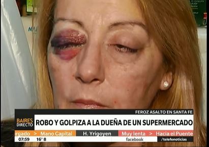 Feroz ataque a la dueña de un supermercado en Santa Fe