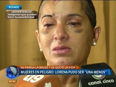 Lorena pudo ser "una menos": su pareja la baleó y se quitó la vida