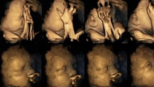 Logran captar la cara de sufrimiento de un feto cuando su madre fuma