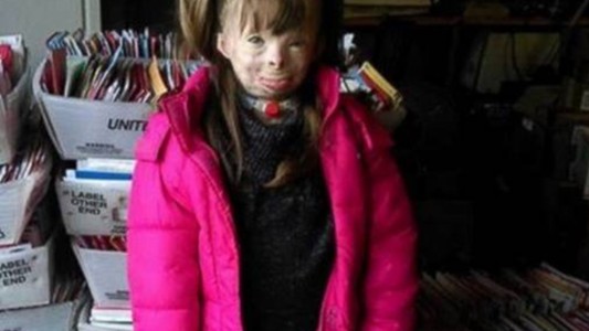 Perdió a su familia en un incendio y ahora recibe regalos de todo el mundo