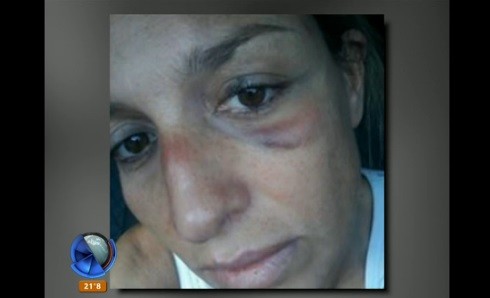 El calvario de Andrea: "Sentí que me moría"