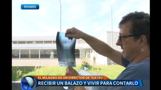 Recibir un balazo y vivir para contarlo