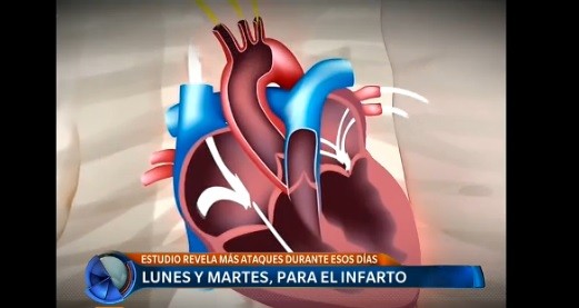 Los lunes y martes se incrementa la cantidad de ataques cardíacos