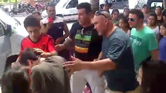 Quemaron con un cigarrillo en la cara al cantante de Márama