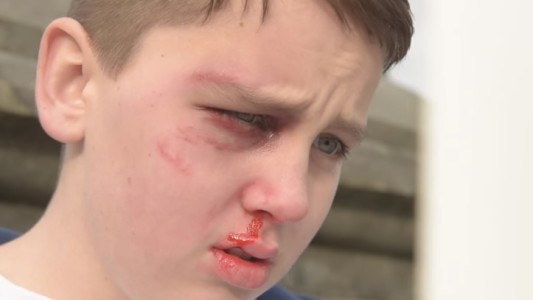 El video de un adolescente para mostrar los dolorosos efectos del ciberbullying