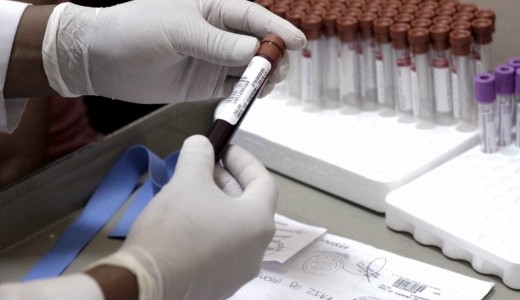 Confirmaron el primer caso autóctono de zika en la Argentina y creen que el contagio fue por vía sexual