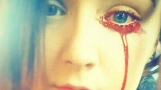 El misterio de la joven que sangra por los ojos