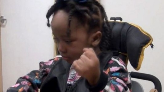 Una nena de 4 años sufrió daño cerebral por error de una dentista