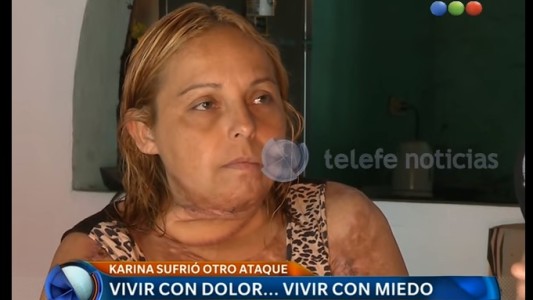 Condenaron a 11 años de cárcel a un hombre por quemar a su esposa