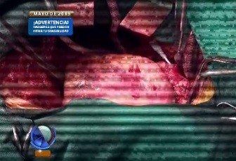 "Con el corazón en la mano"