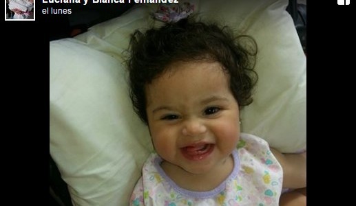 Foto: así está ahora Luciana, la beba siamesa que sobrevivió a la operación