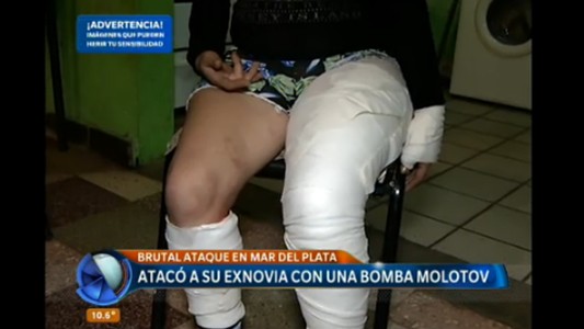 Atacó a su ex novia con una bomba molotov