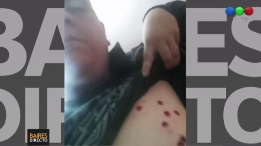 Incidentes en el recital de La Renga en Pegamino