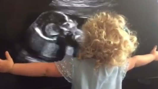#EsViral La niña que rompe en llanto al ver la ecografía de su hermanita