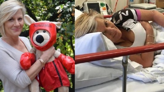 Australia: paseaba en bicicleta, se le tiró un canguro y le rompió las siliconas