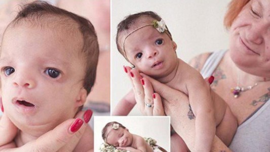 Padres adoptivos abandonaron a una bebé con malformaciones