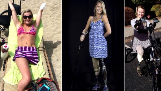 Una bacteria carnívora le devoró medio cuerpo