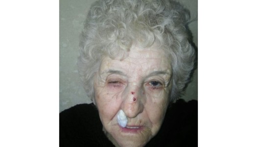 Al denunciar un robo, en la comisaría le pidieron un examen ginecológico y anal