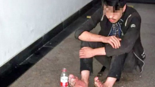 La historia del chino al que se le "pudrieron" los pies tras jugar 6 días seguidos a los videojuegos