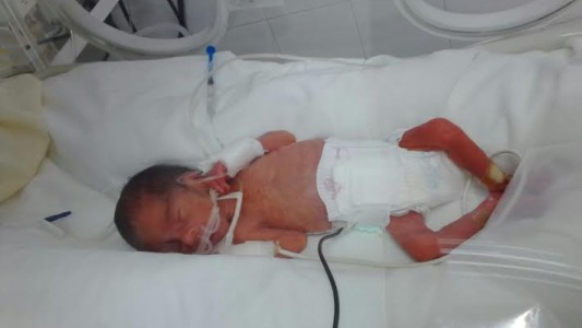 La historia del bebé al que resucitaron tras "nacer muerto"