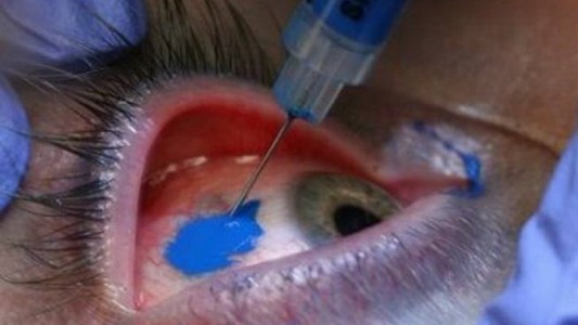 Eyeball y lengua bífida, las señas de una nueva tribu urbana