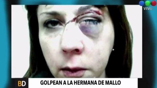 Sospechoso asalto a la hermana del barrabrava prófugo Marcelo Mallo