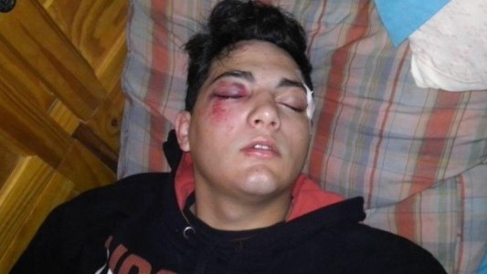 Brutal ataque a un joven en un colectivo: lo golpearon con un palo para robarle