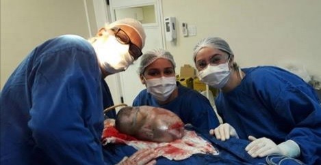 Conmovedor nacimiento de un bebé dentro del saco amniótico se vuelve viral