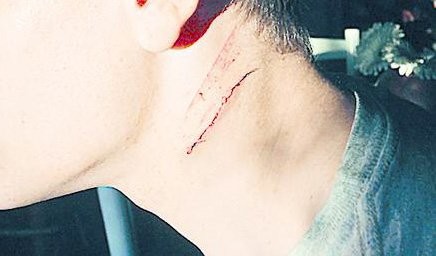 En una pelea de tránsito, un juez hirió a un joven