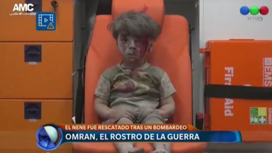 La imagen de un niño herido llama la atención sobre el drama de Alepo