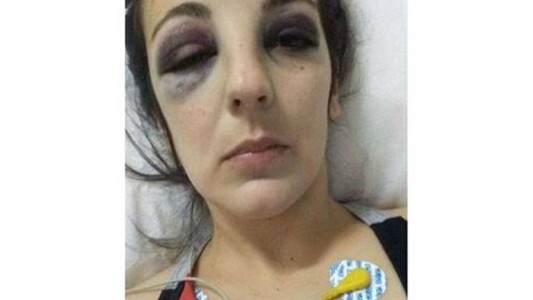 Detuvieron a un futbolista por darle una brutal golpiza a su ex pareja
