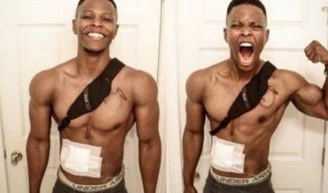 La emotiva historia del joven que no tiene corazón y espera un trasplante