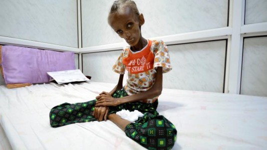 La foto de la joven que refleja el hambre en Yemen