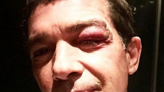 Así quedó Antonio Banderas tras accidentarse durante la filmación de su nueva película