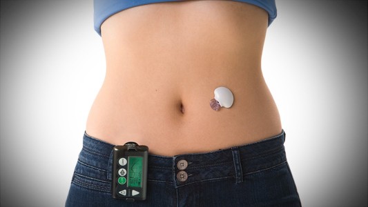 Pruebancon éxito un pancreas artificial hecho por científicos argentinos