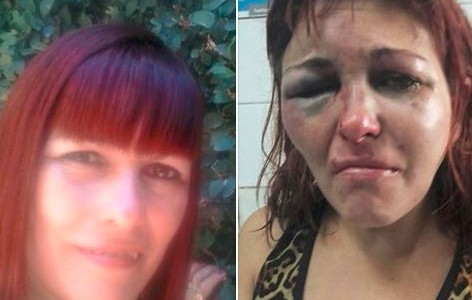 Escapó de la brutal golpiza de su pareja y se salvó de milagro