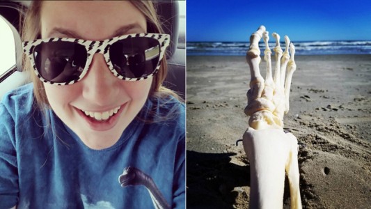 Furor en Instagram por la cuenta de un joven y sus "aventuras" con su pie amputado