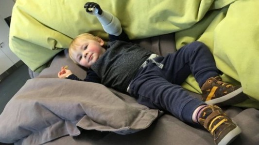 Un padre diseña e imprime una prótesis funcional para su bebé sin mano porque los médicos no se la querían dar