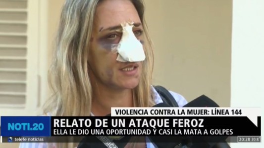 Su ex casi la mata a golpes