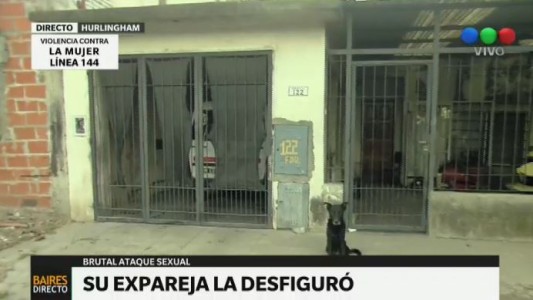 Su ex pareja la desfiguró