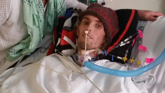 Niegan un trasplante de pulmón a un joven de EE.UU. por haber fumado marihuana